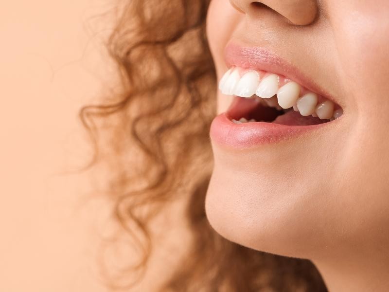 Aparelho Fixo ou Alinhador Invisível: Qual a Melhor Escolha para seu Caso?