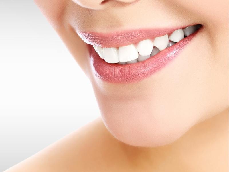 Tudo que você precisa saber sobre Lentes, Laminados e Facetas